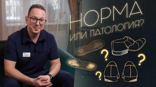 Какой ИЗНОС ОБУВИ – норма, а какой – ТРЕВОЖНЫЙ СИГНАЛ? Разбор ортопеда