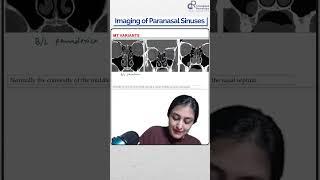 Dr. Zainab Vora Explains Imaging of Paranasal Sinuses | Conceptual Radiology