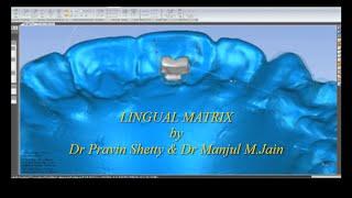 Lingual-Matrix Dr Pravin Shetty & Dr Manjul M.Jain