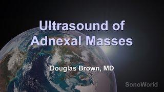 "Ultrasound of Adnexal Masses" Ultrasound SonoWorld Lecture