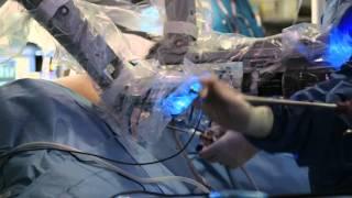 Minimally Invasive Robotic Surgery with the da Vinci Surgical System | UCLA Urology