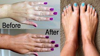 Removal of Sun Tan From Hands & Feet At Home | Hands & Feet Brightening