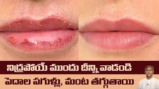 Home Remedy for Dry Lips | Reduces Cracked Lips | Get Beautiful Lips | Dr. Manthena's Health Tips