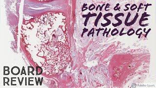 Bone & Soft Tissue Pathology Board Review: 20 Classic Cases (McGill pathology residents)