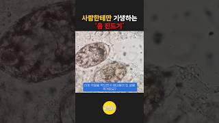 사람의 각질만 먹고 사는 '옴 진드기'