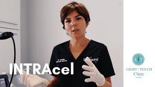 INTRAcel Treatment at Light Touch Clinic Surrey