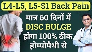 Best Homeopathic medicine for L4 L5 disc bulge & Back Pain