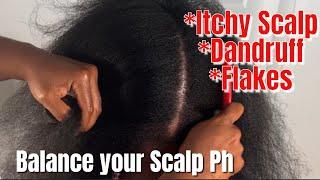 Get Rid of Dandruff and Flakes  Balance your Scalp Ph