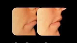 Celebrity Dentist Of Beverly Hills -  Full Mouth Reconstruction - DR. RODNEY RAANAN DDS