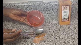 Natural remedy for dark spot remover and hyperpigmentation | @MiatorV DIY