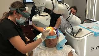 Artas Robotic Hair Restoration Procedure, Beverly Hills Hair MD 2022