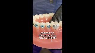 Broken Braces? Here's What To Do...  #shorts