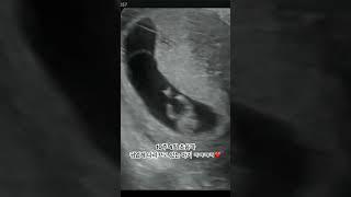 #초음파 #초음파영상 #10주차태아 #10주4일 #임신기록 #baby #10w4d #뱀띠맘