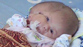 Parents Pray for Miracle After Their Baby Is Born With 2 Faces