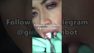 Dentist drilling a woman's teeth  #zahnärztin #zahnärztin #dentist #dentiste #dentista #dentalclinic