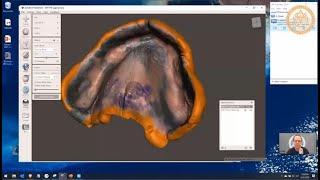 How to Create Perfect Master Jaw Scans for exocad/3Shape/BlueSky using a Reference Denture Technique