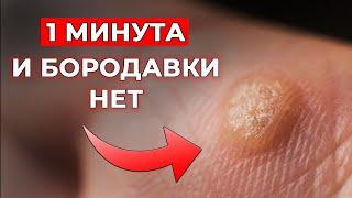 Всего один продукт - и папилломы исчезнут навсегда! / Народное средство от папиллом