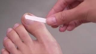 How to use Schollmed Once Weekly* Fungal Nail Treatment