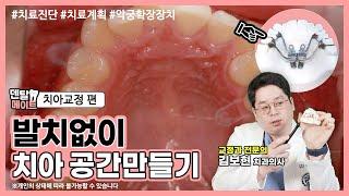 치아교정 발치없이 치아 공간 만들 수 있나요? (악궁확장장치)  [비발치교정케이스 치료진단, 치료과정, 치료계획]  | 덴탈메이트