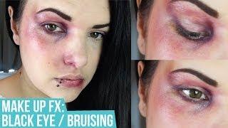 MAKEUP SFX: Black Eye / Bruising