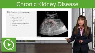 Chronic Kidney Disease: Definition with Case – Nephrology | Lecturio