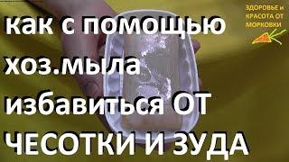 как с помощью хозяйственного мыла избавиться ОТ ЧЕСОТКИ И ЗУДА ?