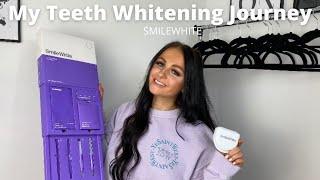 MY TEETH WHITENING JOURNEY!! WITH SMILEWHITE/YORKSHIRE DENTAL SUITE {FAITHINFASHION}