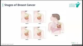 Breast Cancer: Overview for Everyone by Muhammad Usama J