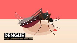 What is Dengue? Causes, Signs and Symptoms, Diagnosis and treatment.