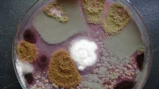 Slide Culture Technique for Fungi - Amrita University