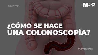 ¿Cómo se hace una colonoscopía? #ExclusivoMSP