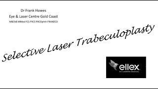 Webinar - Selective Laser Trabeculoplasty