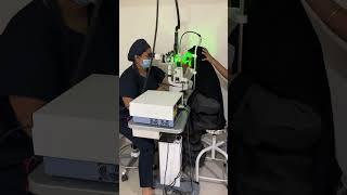 Retinal Laser Surgery/ Barrage laser in 2 minutes!