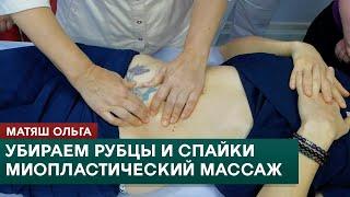 Убираем рубцы и спайки. Миопластический массаж. Матяш Ольга