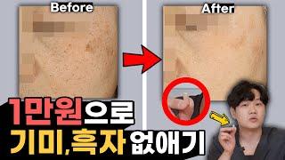 단돈 1만원으로 기미, 흑자 없애기 | 피부과 가기 전에 이것들부터 써보세요!!