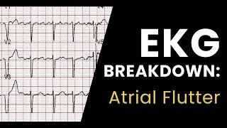 Breaking Down EKGs: Atrial Flutter