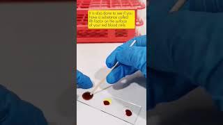 Blood typing Blood grouping #laboratory #mls #cls #medtechstudent #medtech