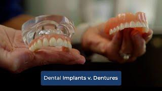 Dental Implants vs. Dentures