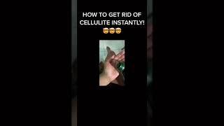 HOW I GET RID OF CELLULITE FAST!  | YES IT REALLY WORKS! 