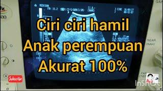 9 Ciri-ciri Hamil Anak Perempuan yang akurat 100%