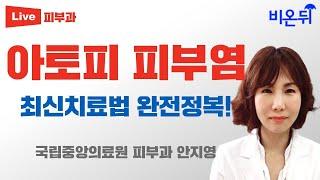 아토피 피부염 최신 치료법 완전정복! / 국립중앙의료원 피부과 안지영