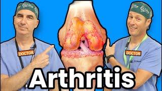 Treating Knee Arthritis Without Surgery