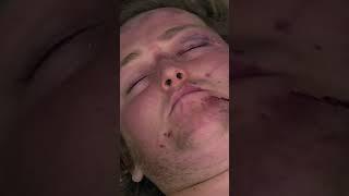 He's never going to walk again | 24 Hours in A&E | Medical Documentary