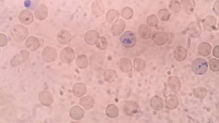 reticulocyte