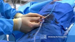 FFR Basics: Performing an FFR Procedure - Mort Kern, MD