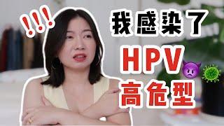 做愛戴套依然感染高危HPV？陽性轉陰我是怎麼做到的？| Carrie雨千