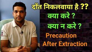 दाँत निकलवाने के बाद सावधानियाँ | After Extraction Care | Dry Socket से बचे !