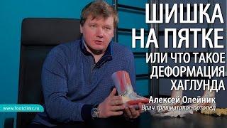 ШИШКА НА НОГЕ ВЫШЕ ПЯТКИ или что такое деформация Хаглунда Алексей Олейник #footclinic