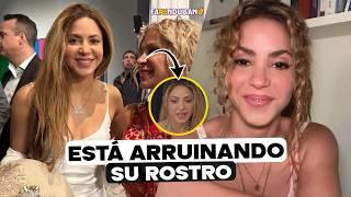 POR ESTO DICEN QUE SHAKIRA ESTÁ ARRUINANDO SU ROSTRO.