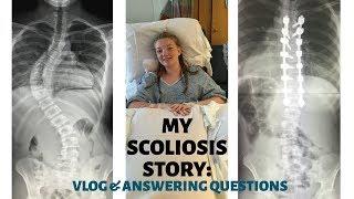 VLOG: having scoliosis